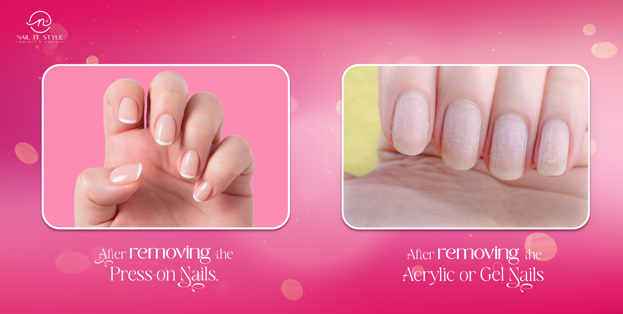 Press-on Nails Vs Artificial Nails